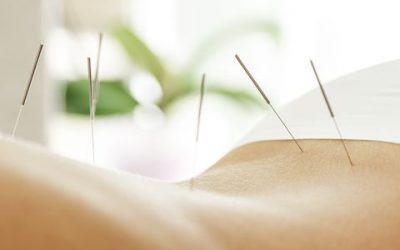 How Does Acupuncture Work For Weight Loss?