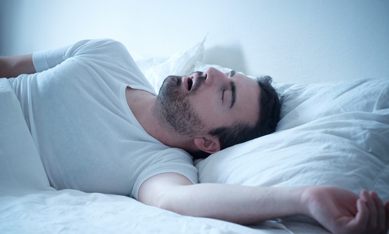 10+ Sleep Apnea Causes & Symptoms in 2019